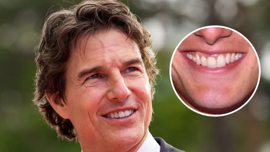 Tom Cruise smile story